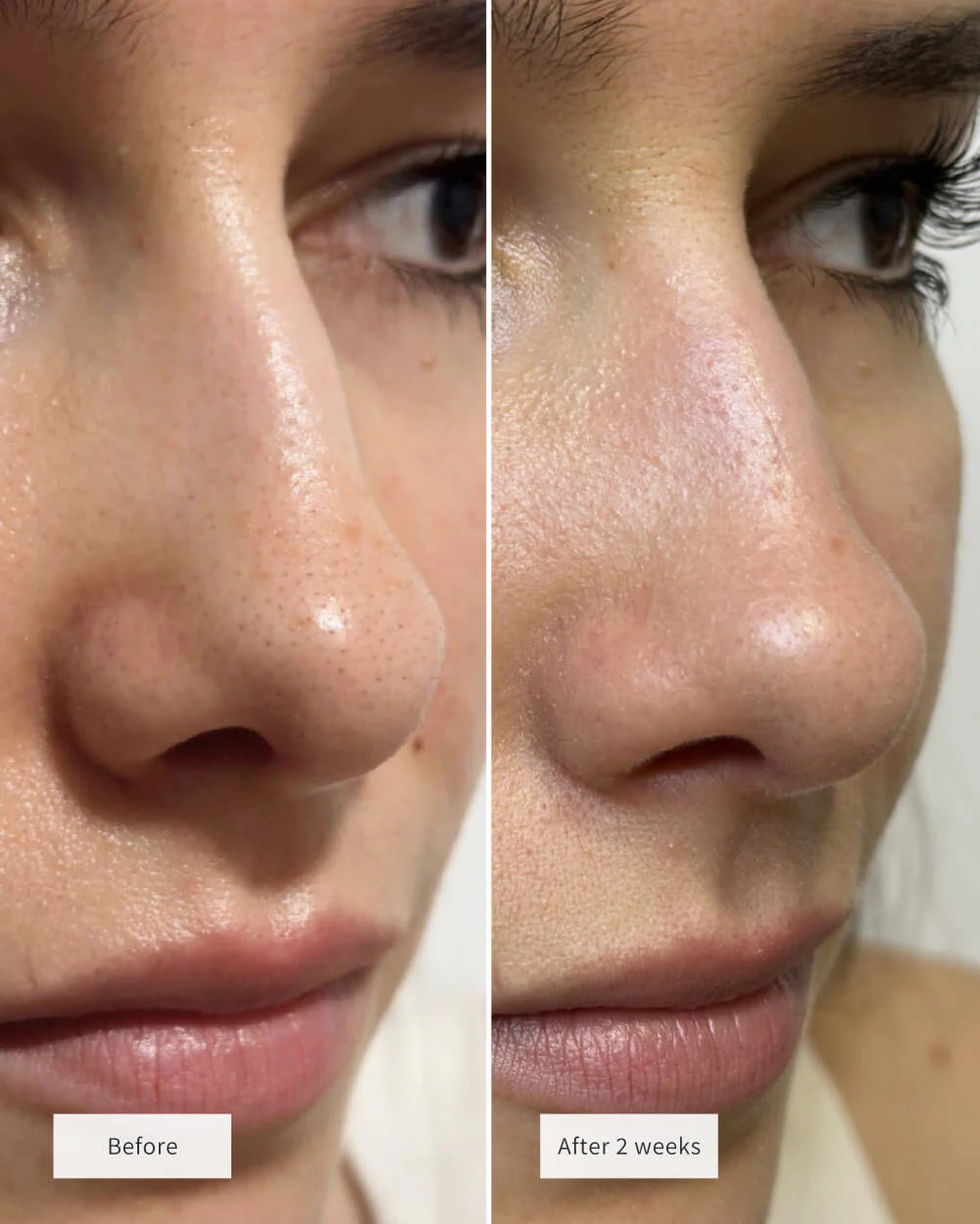 Nose Patches (8x Per box)