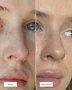 Nose Patches (8x Per box)