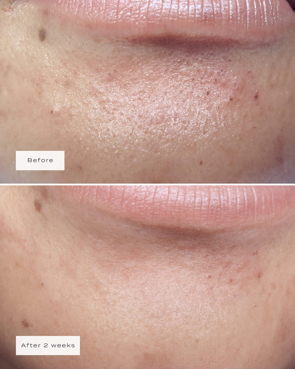 CHIN PATCHES (8x Per Box)