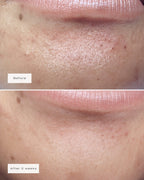 CHIN PATCHES (8x Per Box)