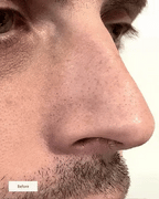 Nose Patches (8x Per box)